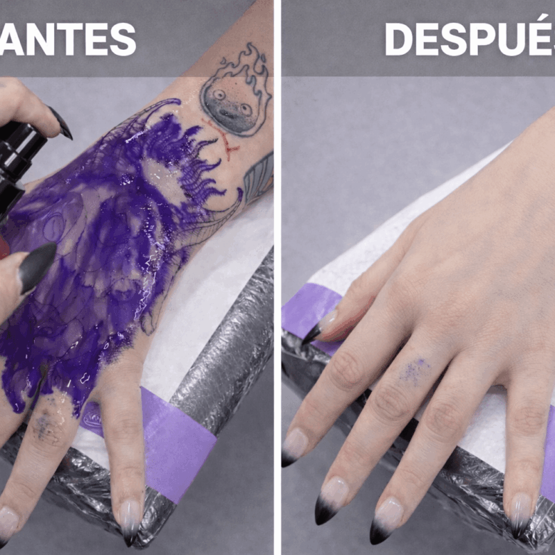 Skulls REMOVAL